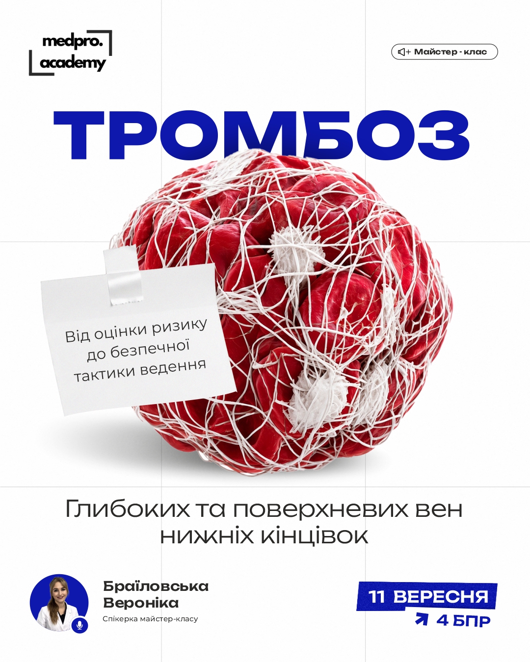 3Тромбоз глибоких та поверхневих вен нижніх кінцівок